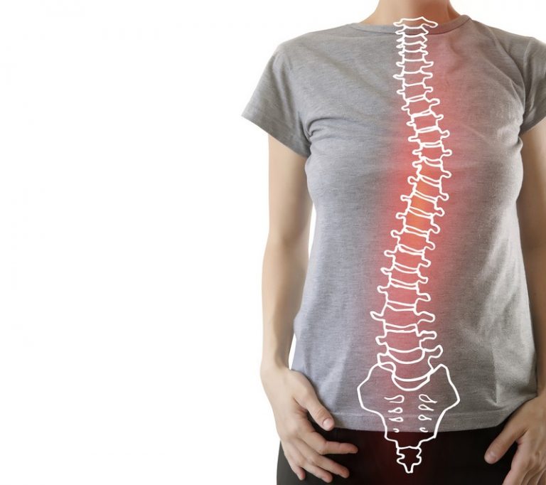 scoliosis treatment Melbourne